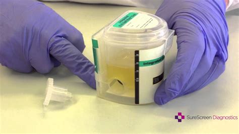 Not every service offered is appropriate for use. . Escreen mcup urine test